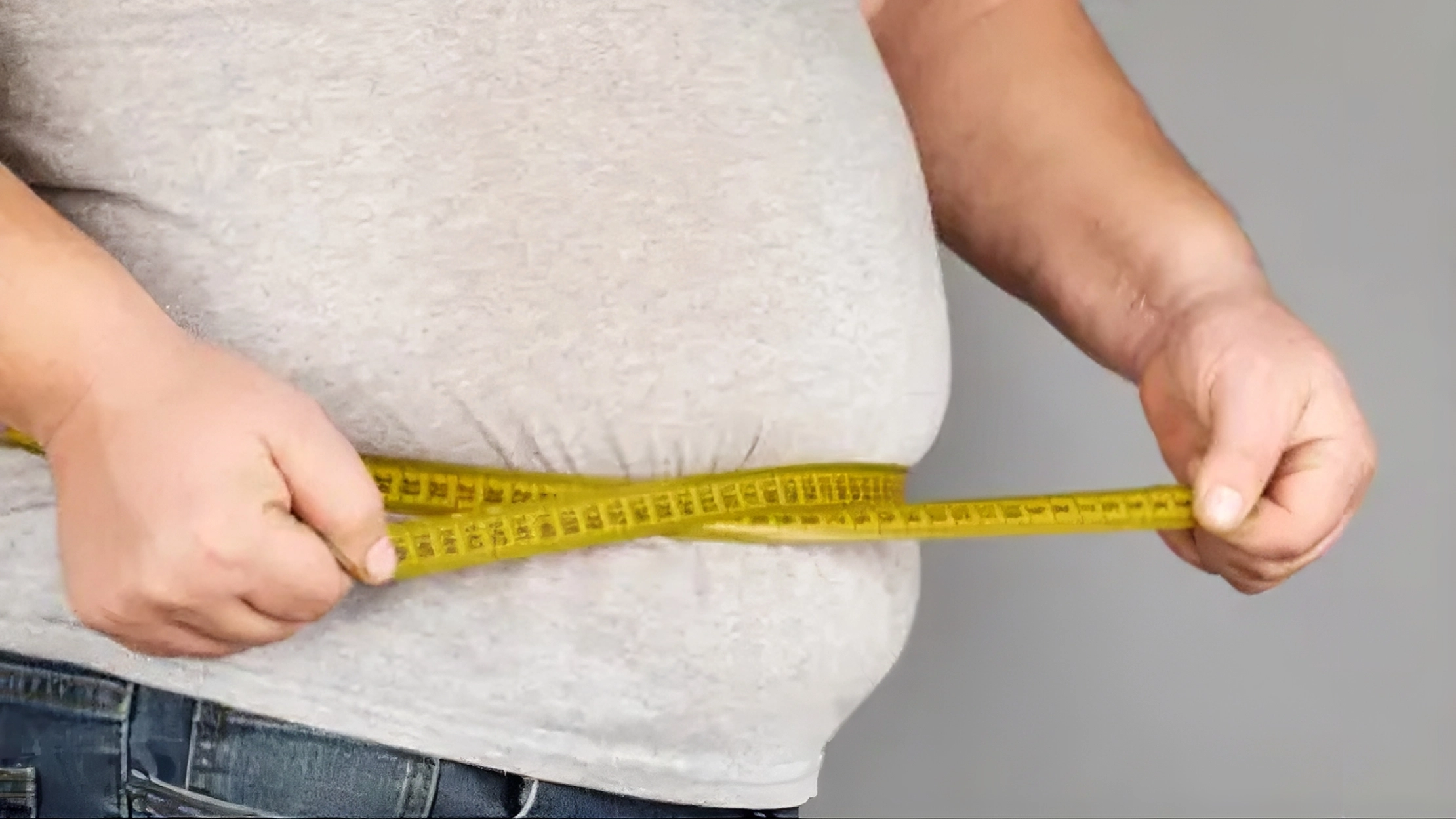 عمليات السمنة